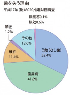 歯を失う理由